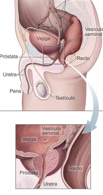 hiperplasia benigna de prostata la enfermedad mas frecuente del varon adulto