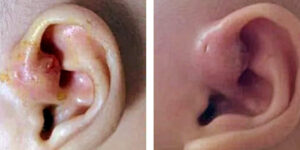 hueso detras de la oreja