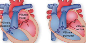 valvula aortica bicuspide